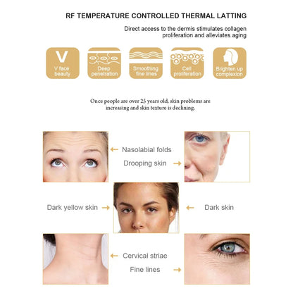 RF Face Lifting Machine – Anti-Aging & Skin Tightening Device